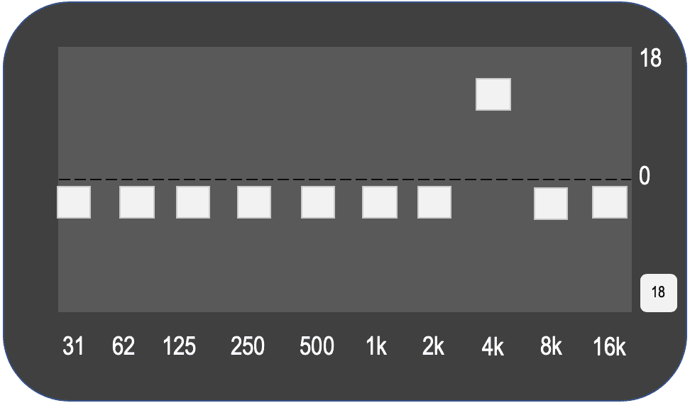 EQ curve: spike around 5-7kHz