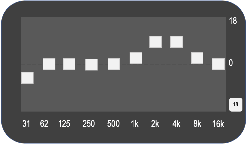 EQ curve: gentle bump in the upper-vocal range